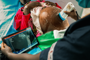 fistola ostetrica 2022